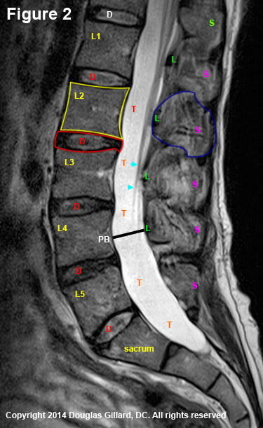 mid-sagittal